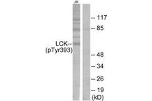 Western Blotting (WB) image for anti-Lymphocyte-Specific Protein tyrosine Kinase (LCK) (pTyr393) antibody (ABIN2888462) (LCK Antikörper  (pTyr393))