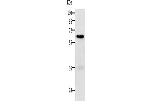 Western Blotting (WB) image for anti-P21-Activated Kinase 1 (PAK1) antibody (ABIN2426800) (PAK1 Antikörper)