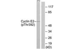 Western Blotting (WB) image for anti-Cyclin E2 (CCNE2) (AA 355-404), (pThr392) antibody (ABIN482177) (Cyclin E2 Antikörper  (pThr392))