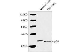 Western blot analysis of tissue lysates using 2 µg/mL Rabbit Anti-p35 Polyclonal Antibody (ABIN398903) The signal was developed with IRDyeTM 800 Conjugated Goat Anti-Rabbit IgG. (P35 (N-Term) Antikörper)