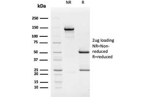 SDS-PAGE Analysis Purified Retinoblastoma (Rb1) Monoclonal Antibody (1F8). (Retinoblastoma 1 Antikörper)