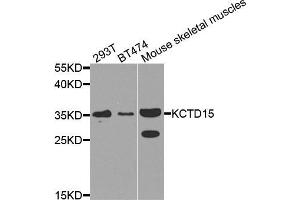 Western blot analysis of extracts of various cell lines, using KCTD15 antibody (ABIN5974815) at 1/1000 dilution. (KCTD15 Antikörper)