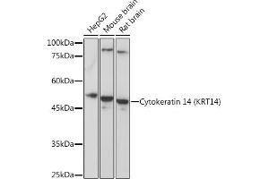 Western blot analysis of extracts of various cell lines, using Cytokeratin 14 (Cytokeratin 14 (KRT14)) Rabbit pAb (ABIN7268092) at 1:5000 dilution. (KRT14 Antikörper  (C-Term))