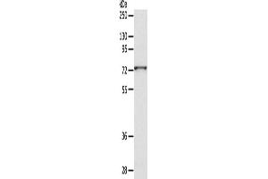 Western Blotting (WB) image for anti-ADAM Metallopeptidase Domain 10 (ADAM10) antibody (ABIN2429028) (ADAM10 Antikörper)