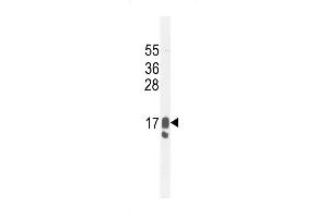 Western blot analysis in MDA-MB231 cell line lysates (35ug/lane). (PIP Antikörper  (C-Term))