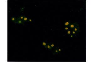 Immunofluorescence assay using anti-Farnesyl antibody on plasmids encoding isoprenylated protein and visualized using FITC- conjugated goat anti-rabbit antibody. (Farnesyl Antikörper)