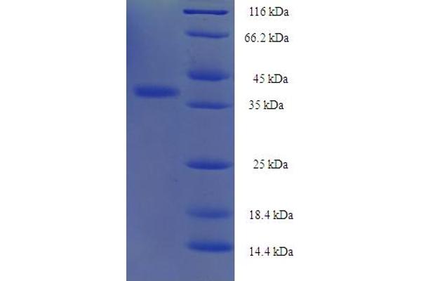 Integrin Alpha2b Protein (CD41) (AA 639-887, partial) (His-SUMO Tag)