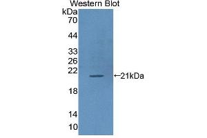 Western blot analysis of the recombinant protein. (ICAM-3/CD50 Antikörper  (AA 46-197))