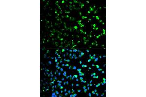 Immunofluorescence analysis of HeLa cells using TYMP antibody (ABIN5970450). (Thymidine Phosphorylase Antikörper)