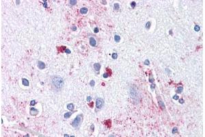 Anti-ENT1 antibody  ABIN1048564 IHC staining of human brain, cortex. (SLC29A1 Antikörper  (Internal Region))