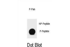 Dot blot analysis of Phospho-PTEN- Antibody Phospho-specific Pab (ABIN6241051 and ABIN6578936) on nitrocellulose membrane. (PTEN Antikörper  (pThr366))