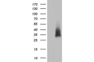 Western Blotting (WB) image for anti-Adiponectin (ADIPOQ) (AA 19-244) antibody (ABIN2715774) (ADIPOQ Antikörper  (AA 19-244))
