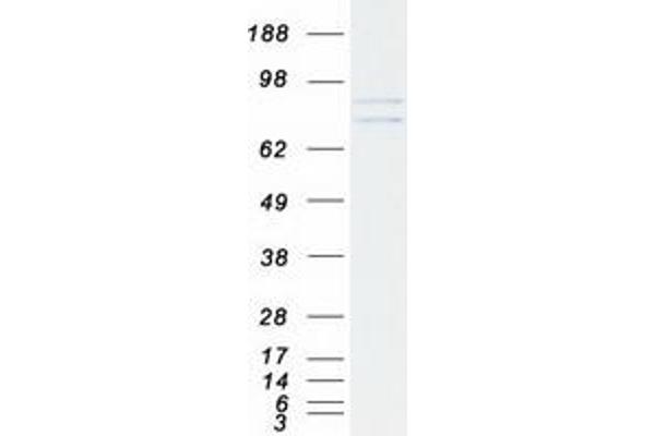 ODF2 Protein (Transcript Variant 1) (Myc-DYKDDDDK Tag)