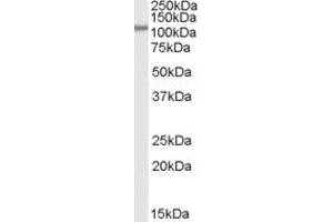 Western Blotting (WB) image for anti-Serine/threonine-Protein Phosphatase 4 Regulatory Subunit 3A (SMEK1) (Internal Region) antibody (ABIN2466283) (SMEK1 Antikörper  (Internal Region))