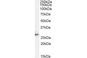 Image no. 1 for anti-Tumor Protein D52 (TPD52) (C-Term) antibody (ABIN375255) (TPD52 Antikörper  (C-Term))