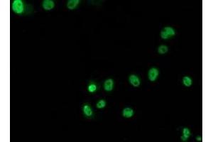 Anti-TP53 mouse monoclonal antibody (ABIN2454617) immunofluorescent staining of COS7 cells transiently transfected by pCMV6-ENTRY TP53 (RC200003). (p53 Antikörper)