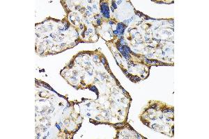 Immunohistochemistry of paraffin-embedded human placenta using TLR3 Rabbit pAb (ABIN6130066, ABIN6149219, ABIN6149220 and ABIN6215465) at dilution of 1:100 (40x lens). (TLR3 Antikörper  (AA 464-647))
