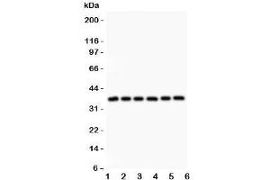 Western blot testing of Crk antibody and Lane 1:  rat spleen;  2: (r) thymus;  3: (r) liver;  4: mouse brain;  5: human HeLa;  6: (h) SMMC-7721 lysate. (Crk Antikörper  (AA 2-246))