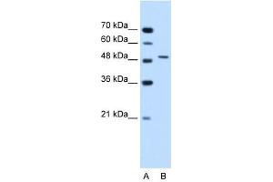 Semenogelin I antibody used at 1. (SEMG1 Antikörper  (N-Term))