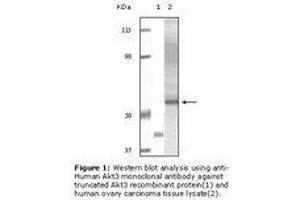 Image no. 1 for anti-V-Akt Murine Thymoma Viral Oncogene Homolog 3 (Protein Kinase B, Gamma) (AKT3) antibody (ABIN232105) (AKT3 Antikörper)