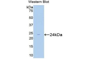 Detection of Recombinant Smad2, Mouse using Polyclonal Antibody to Mothers Against Decapentaplegic Homolog 2 (Smad2) (SMAD2 Antikörper  (AA 272-467))