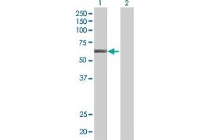 Lane 1: ALDH4A1 transfected lysate ( 61. (ALDH4A1 293T Cell Transient Overexpression Lysate(Denatured))