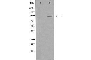 Western blot analysis of extracts of hela , using PIWIL4 antibody. (PIWIL4 Antikörper  (N-Term))