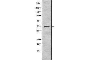 Western blot analysis of ALDH3A1 using K562 whole cell lysates (ALDH3A1 Antikörper  (C-Term))