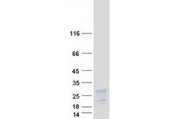 HBXIP Protein (Myc-DYKDDDDK Tag)