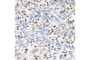 Immunohistochemistry of paraffin-embedded rat ovary using PBRM1 Rabbit mAb (ABIN1512585, ABIN3020942, ABIN3020943 and ABIN7101308) at dilution of 1:100 (40x lens). (Polybromo 1 Antikörper)