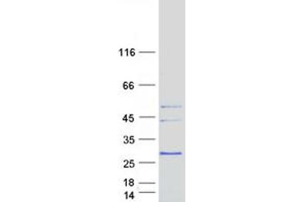 MARCH2 Protein (Transcript Variant 1) (Myc-DYKDDDDK Tag)