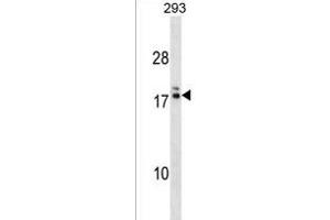 HIATL2 Antibody (N-term) (ABIN1538895 and ABIN2838153) western blot analysis in 293 cell line lysates (35 μg/lane). (HIATL2 Antikörper  (N-Term))