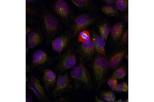 Immunofluorescence (IF) image for anti-Nuclear Factor of kappa Light Polypeptide Gene Enhancer in B-Cells 1 (NFKB1) (pSer337) antibody (ABIN1870464) (NFKB1 Antikörper  (pSer337))