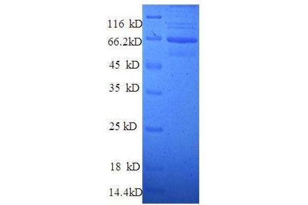 TLN1 Protein (AA 92-399, partial) (GST tag)