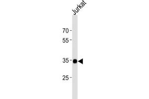 Western Blotting (WB) image for anti-SRY (Sex Determining Region Y)-Box 18 (SOX18) antibody (ABIN2998551) (SOX18 Antikörper)