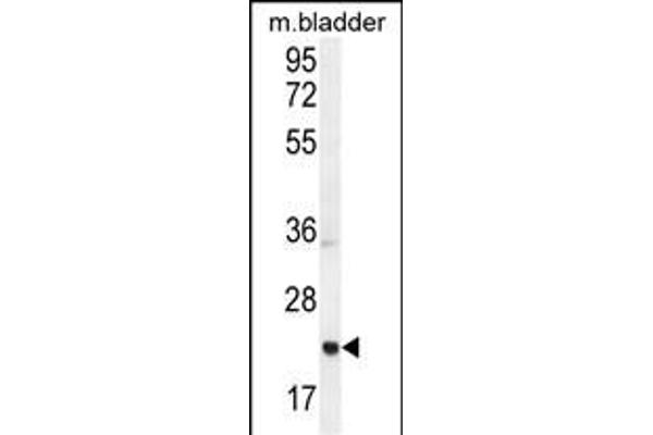 ASCL2 Antikörper  (N-Term)