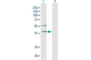 Western Blotting (WB) image for anti-Argonaute 2 (AGO2) (AA 1-377) antibody (ABIN565346)