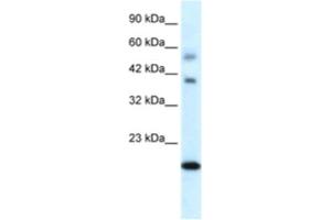 Western Blotting (WB) image for anti-BolA-like Protein 1 (BOLA1) antibody (ABIN2460373) (BOLA1 Antikörper)
