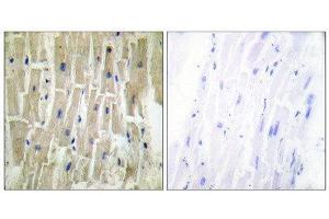 Immunohistochemistry (IHC) image for anti-PDZ and LIM Domain 1 (PDLIM1) (Internal Region) antibody (ABIN1848910) (PDLIM1 Antikörper  (Internal Region))