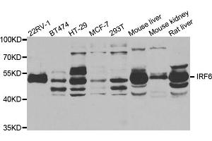 Western blot analysis of extracts of various cell lines, using IRF6 antibody. (IRF6 Antikörper)