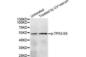 Western Blotting (WB) image for anti-Tumor Protein P53 (TP53) (pSer9) antibody (ABIN1870676) (p53 Antikörper  (pSer9))