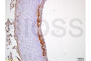 Formalin-fixed and paraffin embedded rabbit carotid artery tissue labeled with Anti-CD54/ICAM-1 Polyclonal Antibody, Unconjugated (ABIN707606) at 1:400 followed by conjugation to the secondary antibody and DAB staining (ICAM1 Antikörper  (AA 451-505))