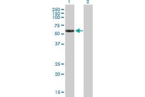 Western Blot analysis of MMP19 expression in transfected 293T cell line by MMP19 MaxPab polyclonal antibody. (MMP19 Antikörper  (AA 1-508))