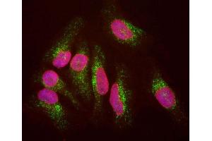 HeLa cells staining with ABIN1580432 (green), and counterstained with ’s chicken polyclonal antibody to Lamin A/C, CPCA-LaminAC (red) and DNA (blue). (LAMP1 Antikörper)