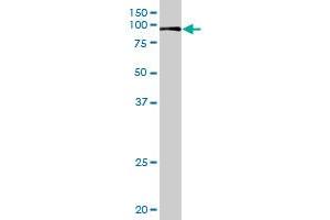 VIL1 MaxPab rabbit polyclonal antibody. (Villin 1 Antikörper  (AA 1-421))