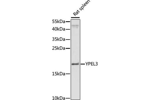 YPEL3 Antikörper  (AA 1-119)