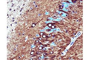 Catalytic alpha (clone 46) staining on rat brain. (PP2A Catalytic alpha (AA 153-309) Antikörper)