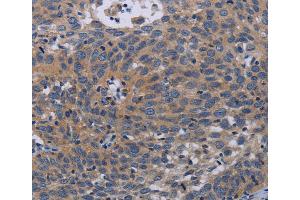 Immunohistochemistry (IHC) image for anti-Pregnancy-Associated Plasma Protein A, Pappalysin 1 (PAPPA) antibody (ABIN2433527) (PAPPA Antikörper)