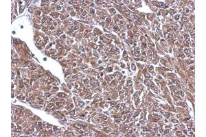 IHC-P Image Immunohistochemical analysis of paraffin-embedded U87 xenograft, using 68kDa Neurofilament Light, antibody at 1:500 dilution. (NEFL Antikörper)