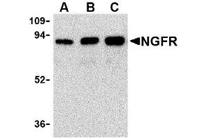 Western Blotting (WB) image for anti-Nerve Growth Factor Receptor (NGFR) antibody (ABIN2479591) (NGFR Antikörper)